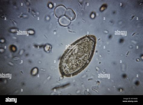  Clonorchis!  A Tiny Trematode Terrorizing Fish and Humans Alike