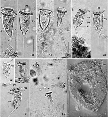  Vorticella! A Microscopic Whirlwind That Dances With the Current